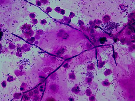 Examen microscopic pe frotiu (preparat proaspăt și/sau colorat) - Synevo