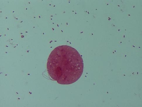 Examen microscopic pe frotiu (preparat proaspăt și/sau colorat) - Synevo